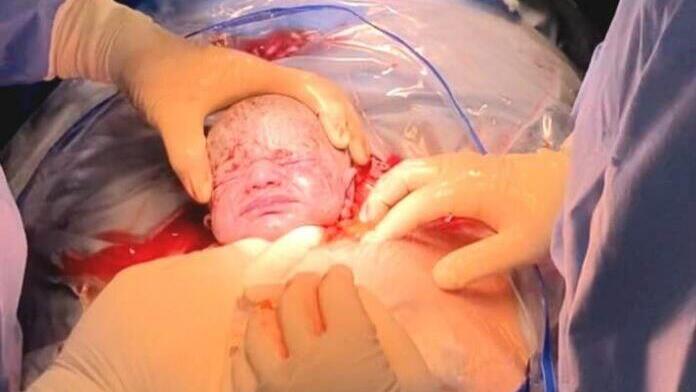 Как выглядят новорожденные дети в первые минуты, фотографии родов - 29 января - ру