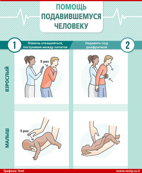 Что делать, если человек подавился?