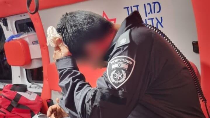 שוטר שנפגע מזריקת אבנים (קרדיט: דוברות המשטרה) שוטר שנפגע מזריקת אבנים במהלך פיזור ההפגנה באיילון