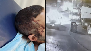 הפצוע מהתקיפה בכפר קאסם