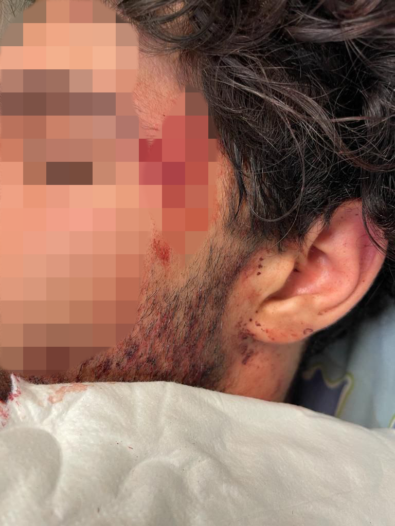 הנער שהותקף בתל אביב. "שמח לשמוע על המעצרים" הנער הערבי שהותקף בתל אביב