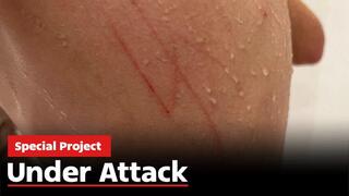 Under attack