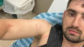 דימה בסוב הוקתף על ידי נהג בכביש מהיר