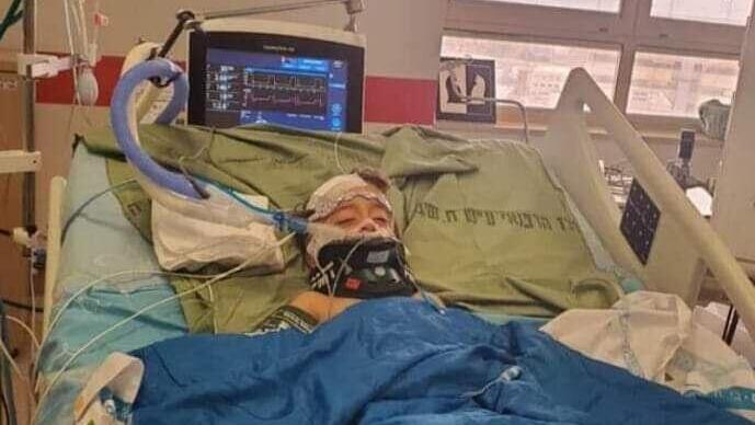 הפעוט מוחמד שנפצע קשה
