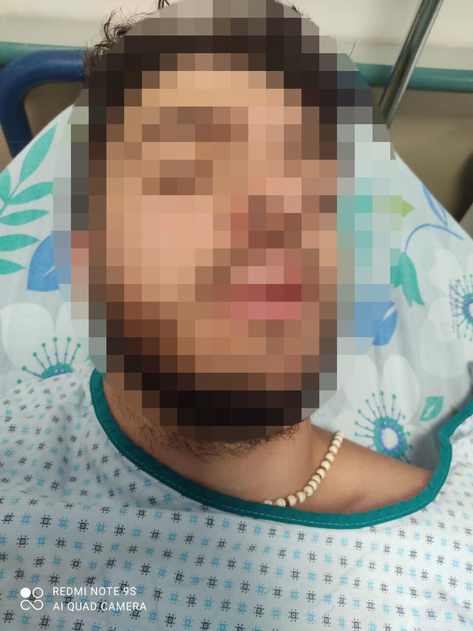 בן 18 שעשה את דרכו חזרה ממסיבת סיום בית הספר הותקף באכזריות ע"י צעירים תושבי הכפר יאנוח