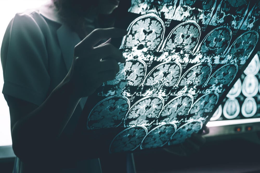 Important to diagnose early (Photo: shutterstock) חקר אלצהיימר