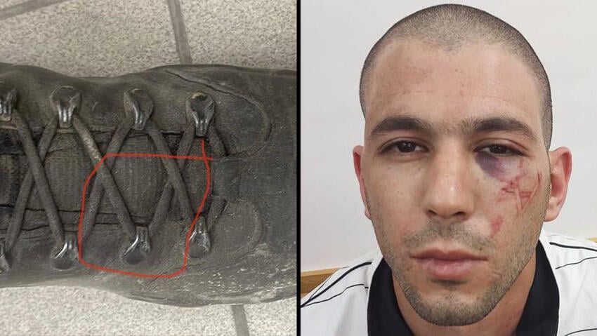 Shoe alleged by police to caue the mark on suspect's face, Arwaa Sheikh Ali תושב מזרח ירושלים החשוד בעבירות סחר בסמים פצוע במעצרו
