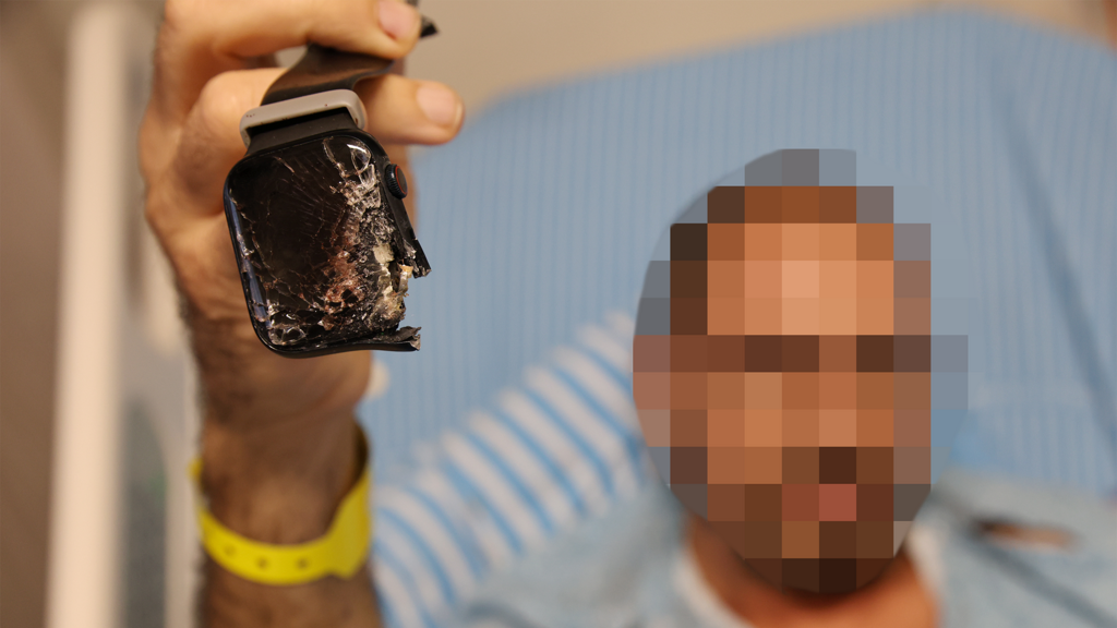 "חששתי ליפול בשבי אז הורדתי את הראש ונסעתי". ג' בבית החולים (צילום: שאול גולן) ג' תושב עוטף עזה