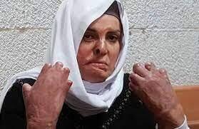 אסראא ג'אבעס