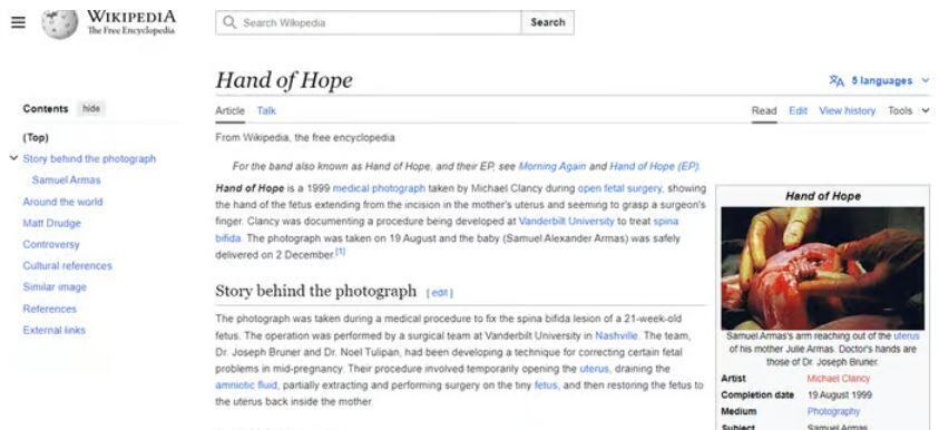Wikipedia page showing Dr. Bruner shaking the hand of an embryo (Photo: Wikipedia ) Wikipedia page showing Dr. Bruner shaking the hand of an embryo