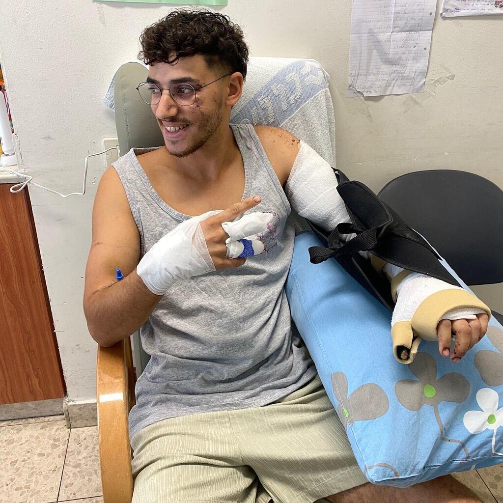 היד רוסקה לחלוטין. סמ"ר רועי ביבי במהלך האשפוז ( צילום: אלבום פרטי) סמ"ר רועי ביבי נפצע קשה ושוחרר מהשיקום