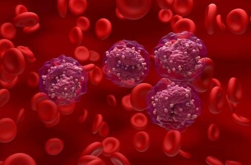 Leukemia: What are the symptoms, risk factors and how do you treat it? - Vimarsana News