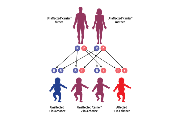 The inheritance of recessive genetic diseases, such as cystic fibrosis. The probabilities of parents who are carriers to have healthy or sick children (Photo: Blamb, Shutterstock) The inheritance of recessive genetic diseases, such as cystic fibrosis. The probabilities of parents who are carriers to have healthy or sick children