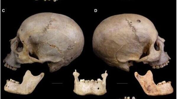 Skulls of ancient Egyptians show signs of surgery (Photo: (Tondini et al., Front. Med., 2024)) גולגלות שהתגלו במצרים העתיקה