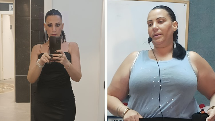 יונית מלכה: "המשקל היה תמיד פינג פונג גם אחרי ניתוח מעקף" יונית מלכה