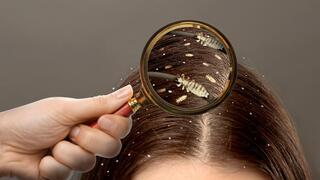 Lice infestation: treating and re-treating – what can be done?