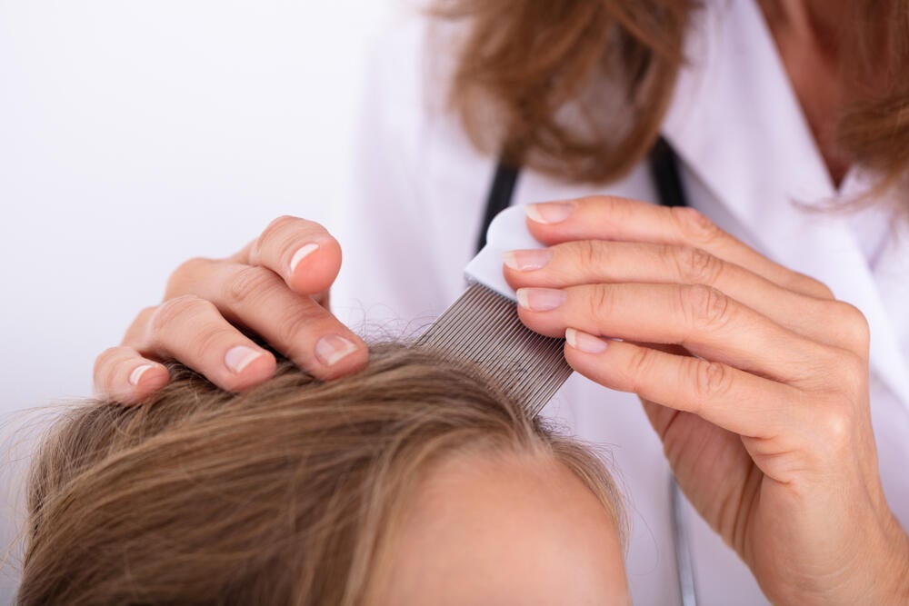 Photo: Shutterstock כינים כינה מסרק צפוף