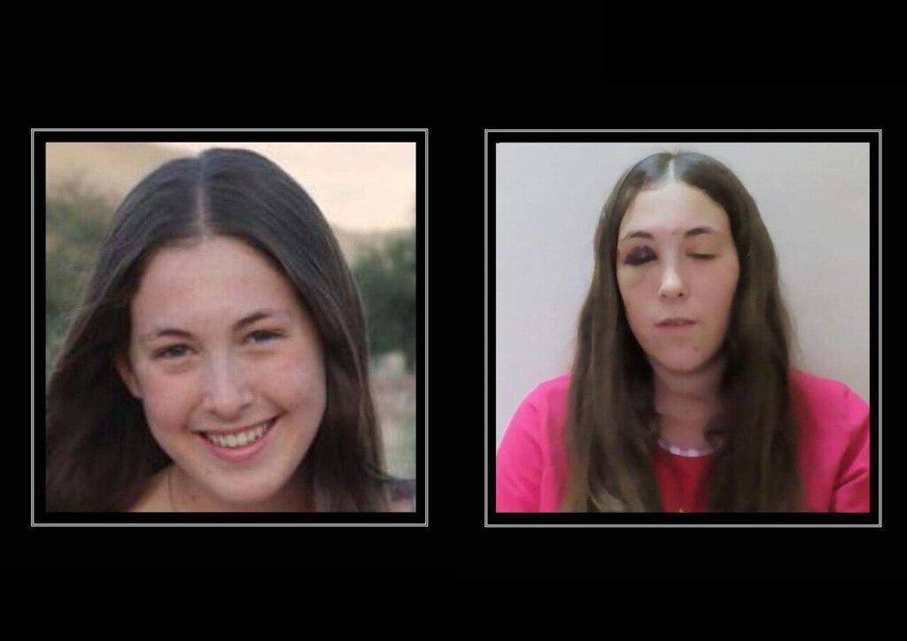 Naama Levy with a black eye in captivity נעמה לוי בימיה הראשונים בשבי