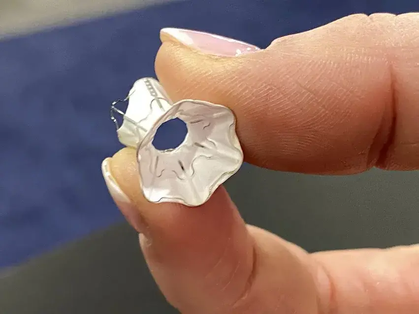 V-Wave implant (Photo: V-Wave) מסתם ללב של חברת ו-וייב (V-Wave) שנמכרה לחברת ג'ונסון אנד ג'ונסון