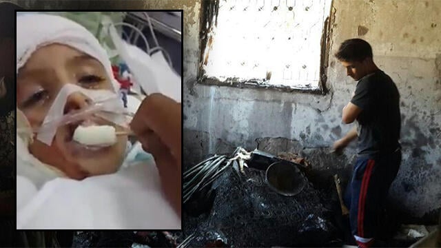 The only survivor of the attack Ahmed Dawabsheh(Photo: Mohammed Shinawi) (צילום: מוחמד שינאווי) The only survivor of the attack Ahmed Dawabsheh(Photo: Mohammed Shinawi)