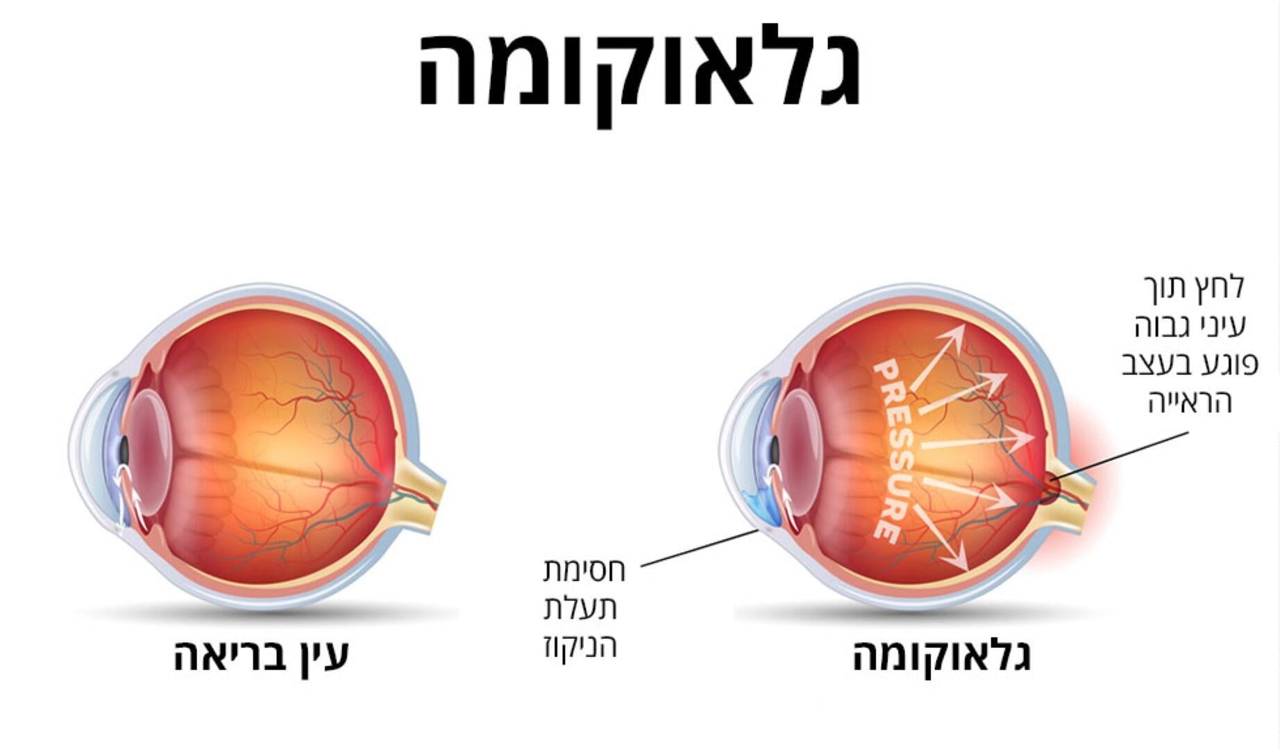 עין עין