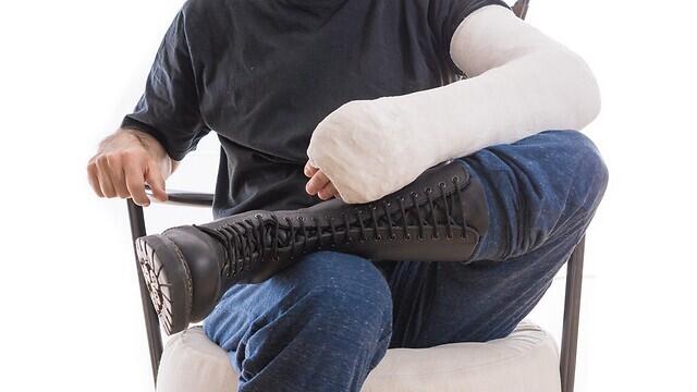 גבס פציעה שבר יד זרוע אילוס אילוסטרציה