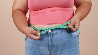 השמנה השמנת יתר