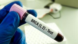 בדיקה לאיתור מוטציה בגן BRCA