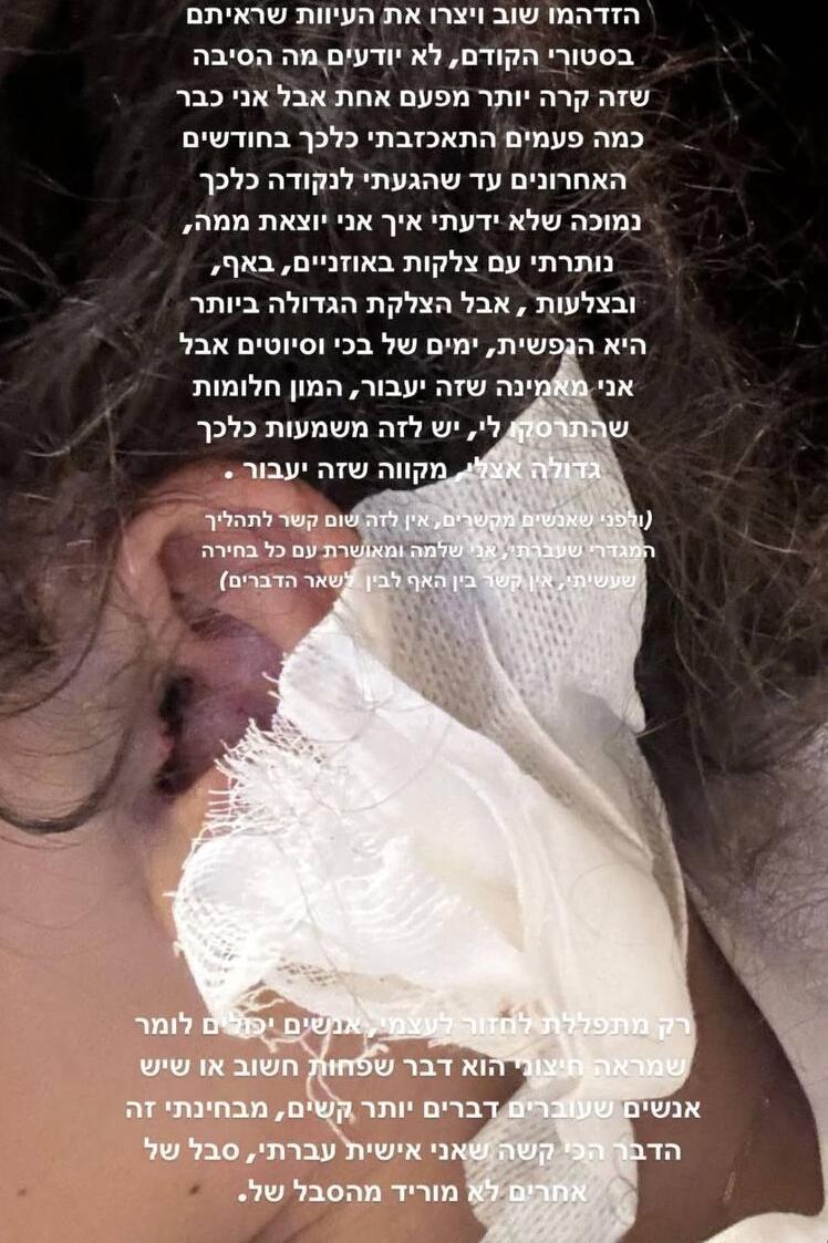 "הצלקת הגדולה ביותר היא הנפשית" (צילום: אינסטגרם) רומי אברג'יל