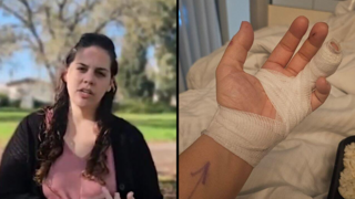 חצאים צופיה דרי תושבת העיר טבריה הותקפה בכביש 