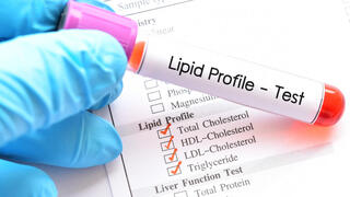 פרופיל שומנים