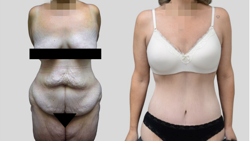 מטופלת של ד"ר טלי פרידמן