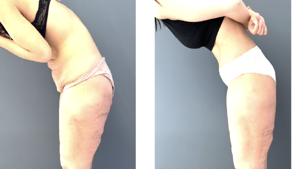 מטופלת של ד"ר ערן מילט