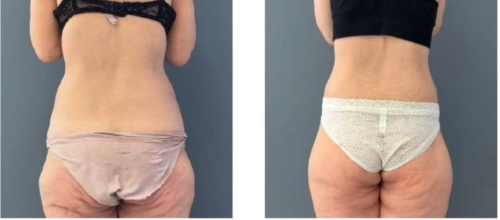 מטופלת של ד"ר ערן מילט