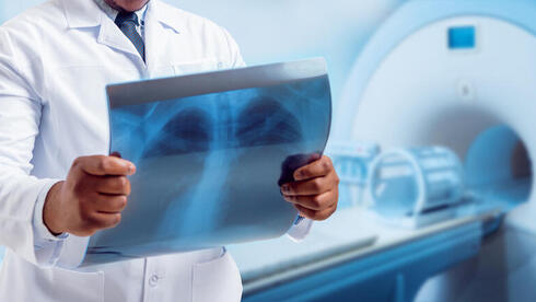 איחור באבחון סרטן: המדינה תשלם 2.1 מיליון שקל