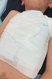 תוצאות הפגיעה בילד yk14353441