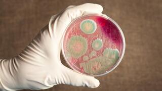 מחלת גחלת כתוצאה מחיידק אנתרקס מחלת גחלת כתוצאה מחיידק אנתרקס