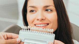 ציפוי שיניים