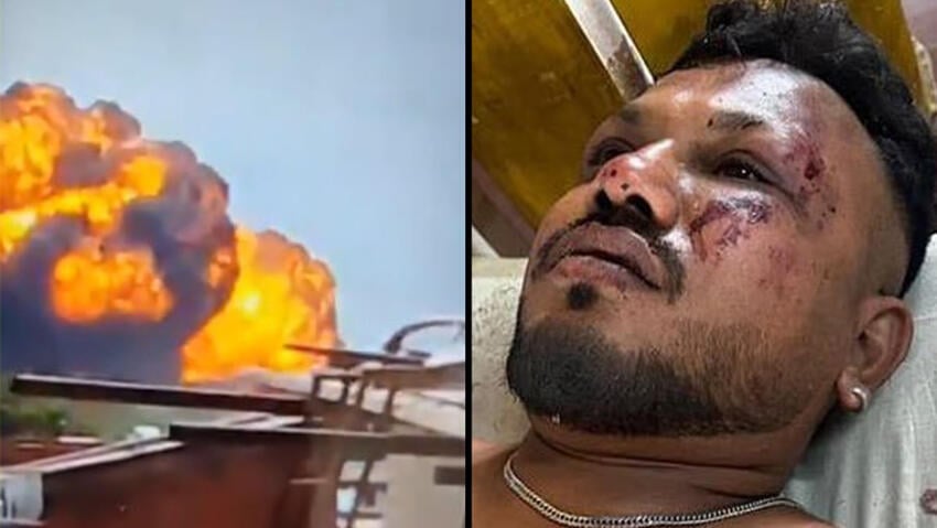 Sole survivor of the Air India crash, 40-year-old Vishwak Kumar Ramesh הודו התרסקות מטוס אחמדאבאד ניצול יחיד וישוואק קומאר ראמש