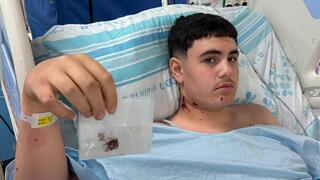 איתי מייסון בן ה 16 מנתניה, חייו ניצלו במזל גדול בנפילת הטיל האיראני בעיר התחתית בחיפהה