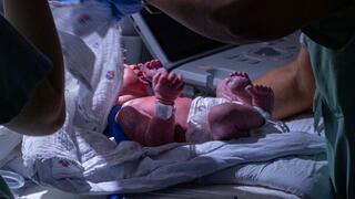 לידה ב חדרי לידה ממוגנים בית החולים איכילוב חדר לידה