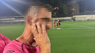 שחקן פגוע אחרי הקטטה 