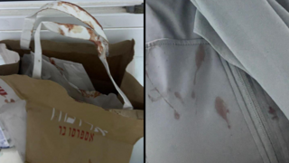 דם על השקית שהחזיקה האישה שהותקפה