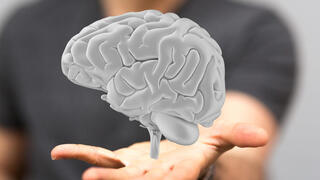 נזק מוחי בעקבות אלצהיימר