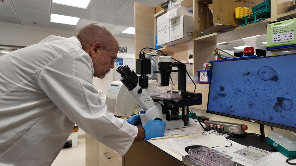 פרופ' בנימין דקל, נפרולוג מבית החולים שיבא, גידל רקמת כליה מתאי גזע