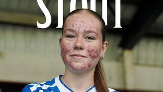 סקאיי סטאוט 