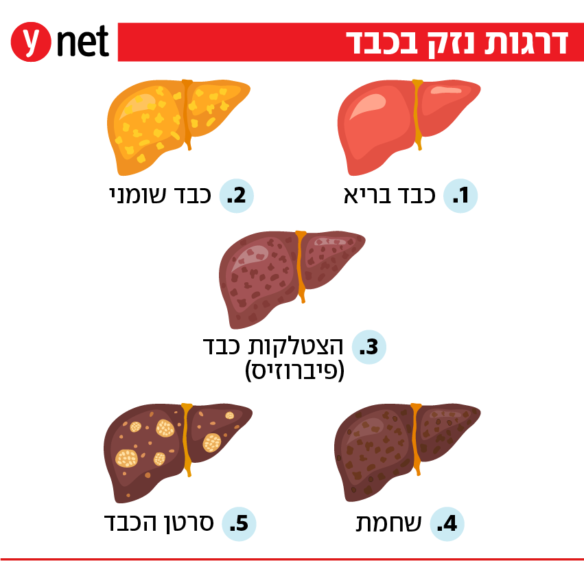 אינפו כבד שומני אינפו כבד שומני