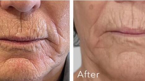 אמי טכנולוגיות