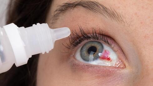 Sudden red spot on the eye? Usually harmless, sometimes a warning