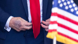 חבורה פצע על כף יד ימין של נשיא ארה